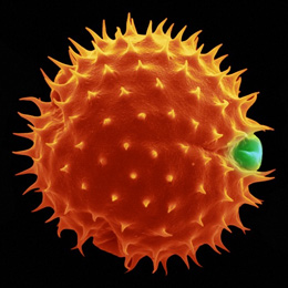 Marigold Pollen image from Wellcome Images